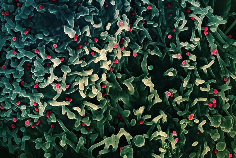 Mpox: OMS confirma circulação de nova variante do vírus