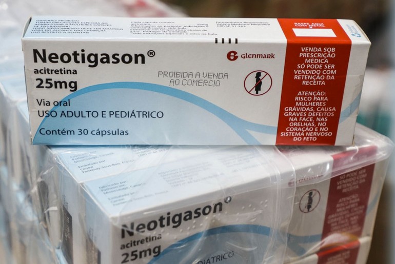 Medicamentos para psoríase podem ser retirados no Case