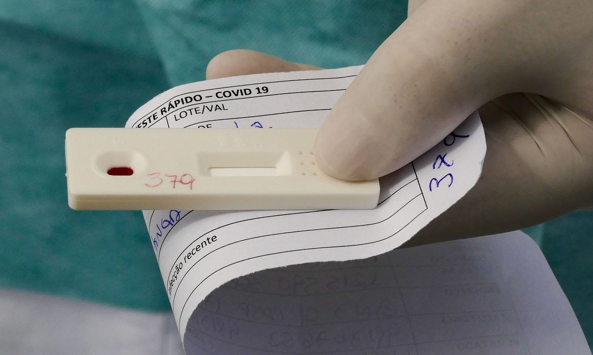 Covid-19: Brasil registra 6 milhões de casos