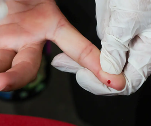 Teste rápido de dengue passa a ser oferecido pelo SUS