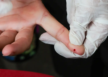 Teste rápido de dengue passa a ser oferecido pelo SUS