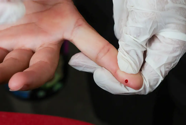 Teste rápido de dengue passa a ser oferecido pelo SUS