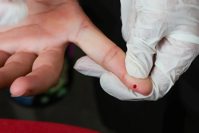 Teste rápido de dengue passa a ser oferecido pelo SUS