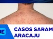 Ministério da Saúde alerta sobre sarampo
