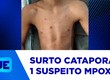 Surto de catapora é registrado numa escola da rede municipal de ensino de São Cristóvão