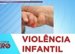Mãe denuncia que filha foi agredida dentro de um berçário particular em Aracaju