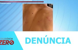 Jovem de 19 anos denuncia ter sido agredido por policiais dentro de casa