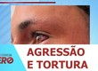 Homem denuncia agressão e tortura supostamente praticadas por policiais em São Cristóvão