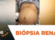 Homem de 40 anos precisa de biópsia renal e família pede solução para obter diagnóstico