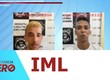 Balanço das últimas 24 horas no IML