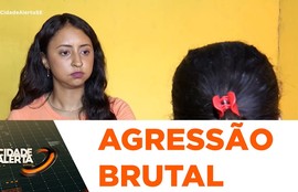 Homem é preso suspeito de arrancar parte da língua de uma mulher com uma mordida