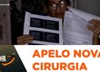 Após rejeição a material cirúrgico, mulher pede ajuda para novo procedimento