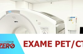 Exame PET/CT é incorporado ao SUS para casos de câncer de mama metastático