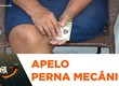 Mulher faz apelo por perna mecânica após sofrer acidente de carro
