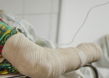 Criança que sofreu descarga elétrica apresenta melhora após internação no Huse