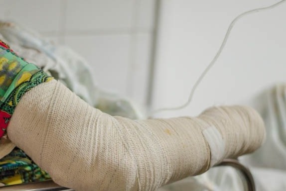 Criança que sofreu descarga elétrica apresenta melhora após internação no Huse