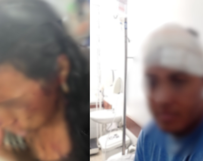 Briga em festa do vaqueiro de Lagarto termina em violência e detenções