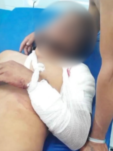 Jogador do Dorense que foi baleado realiza cirurgia no antebraço e passa bem
