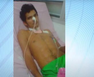 Itaporanga: homem baleado por PM fala sobre o caso; policial também dá sua versão