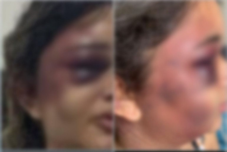 Mulher é espancada pelo ex-companheiro na frente dos filhos em Aracaju