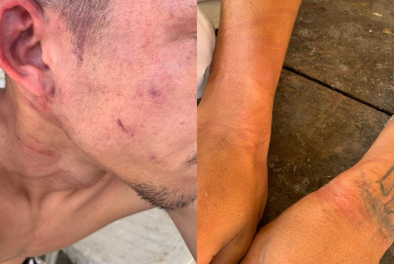 Homem denuncia agressão e tortura praticadas por policiais em São Cristóvão