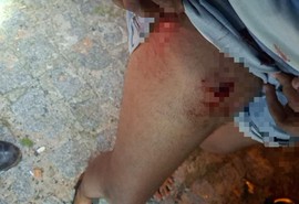 Casal é baleado em via pública no município de Taiçoca de Fora