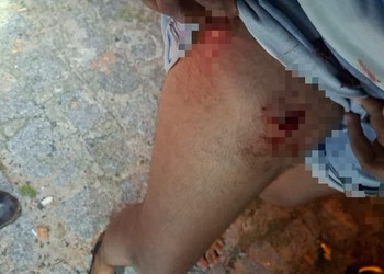 Casal é baleado em via pública no município de Taiçoca de Fora