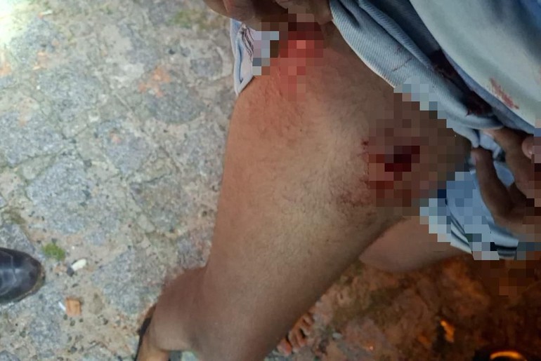 Casal é baleado em via pública no município de Taiçoca de Fora