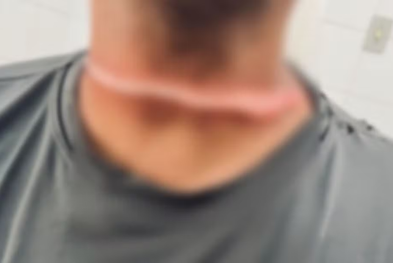 Motociclista fica ferido ao ser atingido por fio em cruzamento movimentado de Aracaju