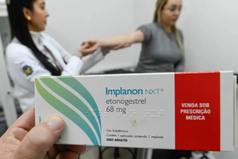 Implanon entra na cobertura obrigatória dos planos de saúde a partir desta segunda-feira (1º)