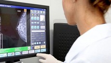 SUS realiza mais de 132 mil mamografias em Sergipe desde 2019