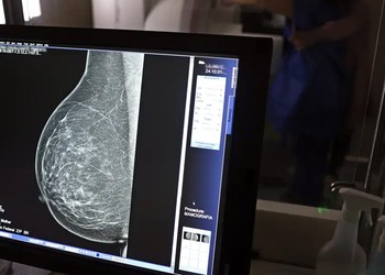 Lei garante mamografia pelo SUS para mulheres a partir dos 40 anos