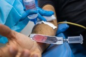 Hemose alerta para estoques baixos de sangue durante período junino