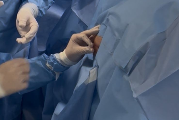 Paciente com paraplegia é submetida a tratamento experimental com polilaminina em Aracaju